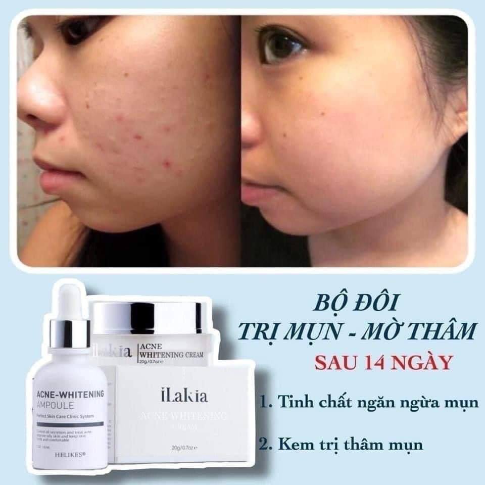 Serum Ngừa Mụn Trắng Da ILAKIA Tinh Chất Ngừa Mụn Rau Má Sạch Mụn Ẩn mụn Đầu Đen Hàn Quốc