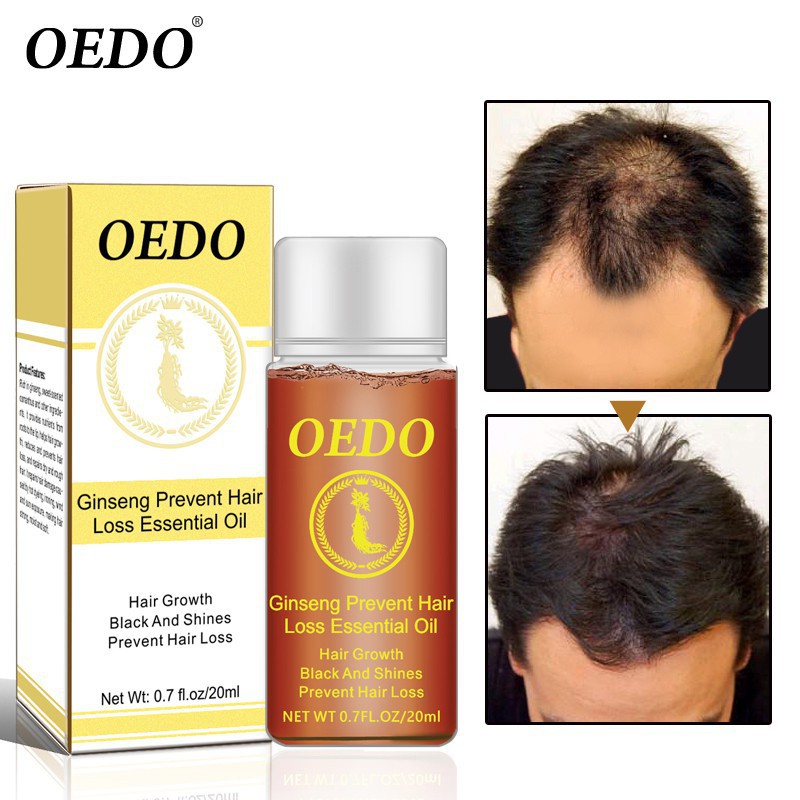 Tinh dầu kích thích mọc tóc OEDO 20ml
