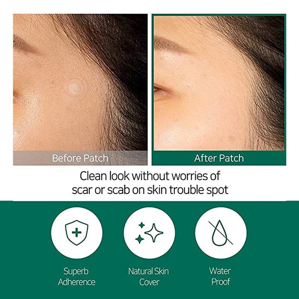 Miếng Dán Mụn Some By Mi Clear Spot Patch (Set 18 miếng dán)