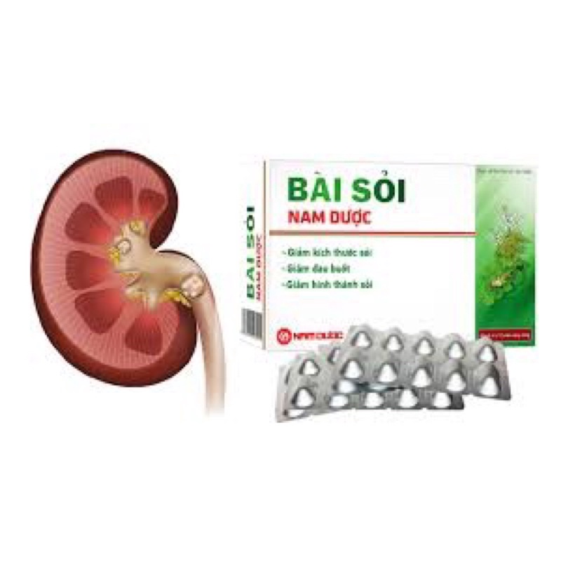 Bài Sỏi Nam Dược - Giảm đau buốc - giảm kích thước sỏi - giảm hình thành sỏi