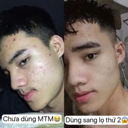 Thảo Dược Ngăn Ngừa, Sạch Mụn Dr Mai | BigBuy360 - bigbuy360.vn