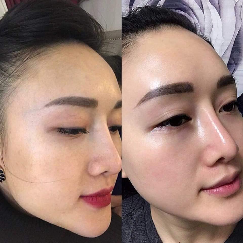 TINH CHẤT MULWANG CẤY CĂNG BÓNG - TRẺ HÓA DA - LÀM ĐẦY SẸO RỔ 10ML NHẬP KHẨU CHÍNH HÃNG - 4218