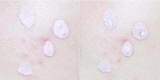 (GRAB / NOWSHIP) (DATE 16-08-2022) [Da Mụn] Dung Dịch Chấm Mụn Mediheal A-Zero Shot Skin Control Pink Dressing | BigBuy360 - bigbuy360.vn