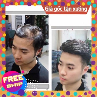 Mái hói nam dạng dán / kẹp siêu da đầu 100%