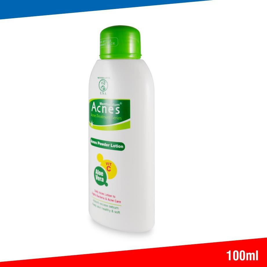 (Hàng Mới Về) Lotion Trị Mụn 100ml Chất Lượng Cao | BigBuy360 - bigbuy360.vn