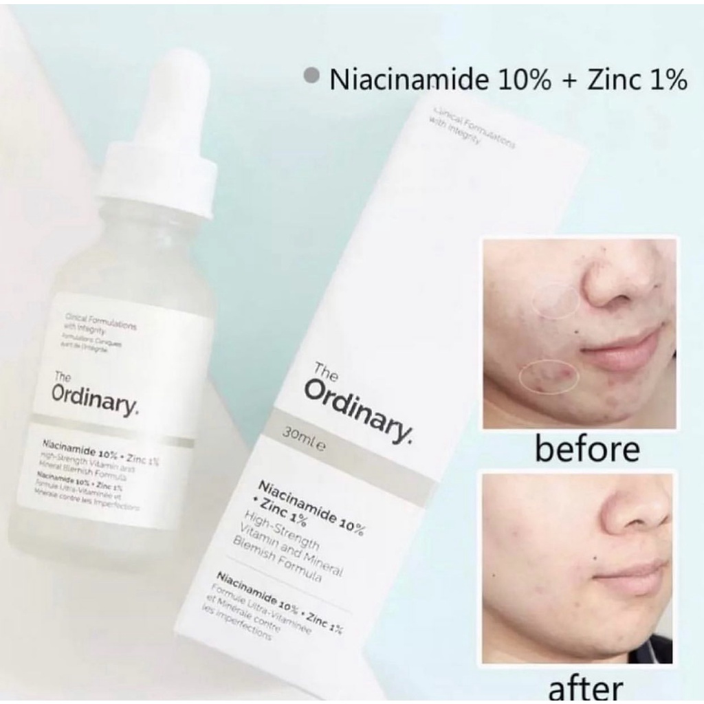 Tinh chất giảm mụn và giảm thâm The Ordinary Niacinamide 10% + Zinc 1%