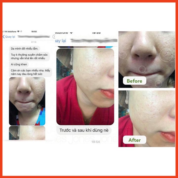 Combo 2 Tuýp Sữa Rửa Mặt Trà Xanh Tảo Biển Cho Da Mụn Nhạy Cảm The Beauty Of Jones