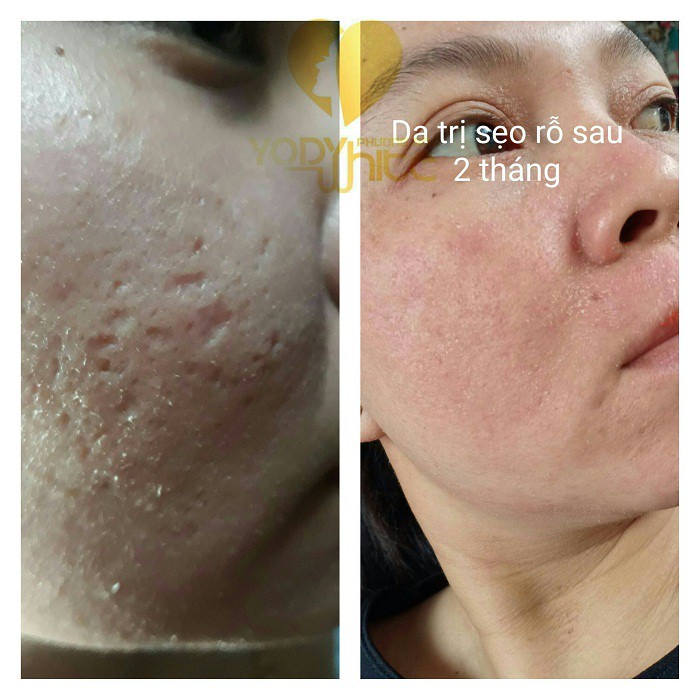 ⚡Kem Cream Plus White chống nắng da nhờn Yody White Phương Anh