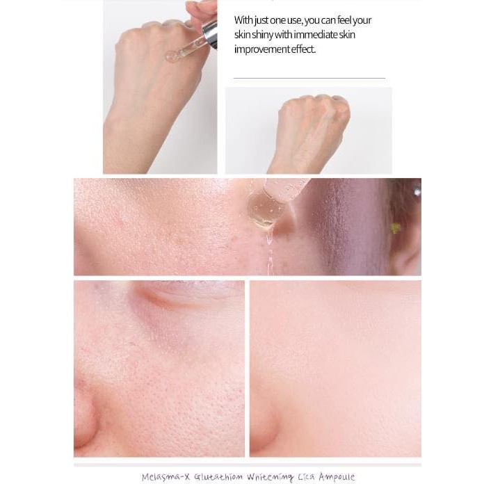 Serum dưỡng trắng Glutathione Whitening Cica Ampoule