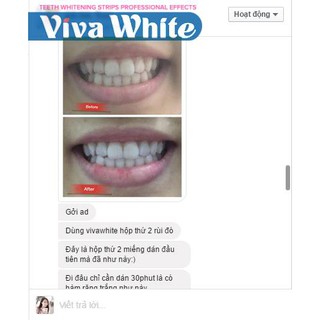 Miếng Dán Làm Trắng Răng Viva White