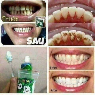 Baking soda ( combo 30 hộp )