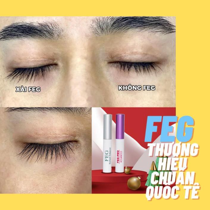 [Cam kết chính hãng] Dưỡng mi xanh FEG (FEG eyelash enhancer) Dưỡng mi dài dày cong với chiết xuất tự nhiên_3ml