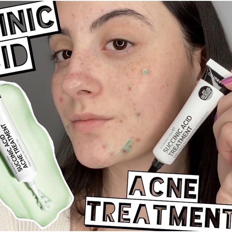 Kem Chấm Mụn The Inkey List Succinic Acid Acne Treatment