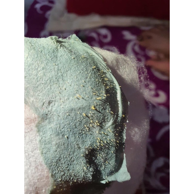 [Gel Hút MỤN Dr ACNE--Hàng cao cấp Chính hãng]