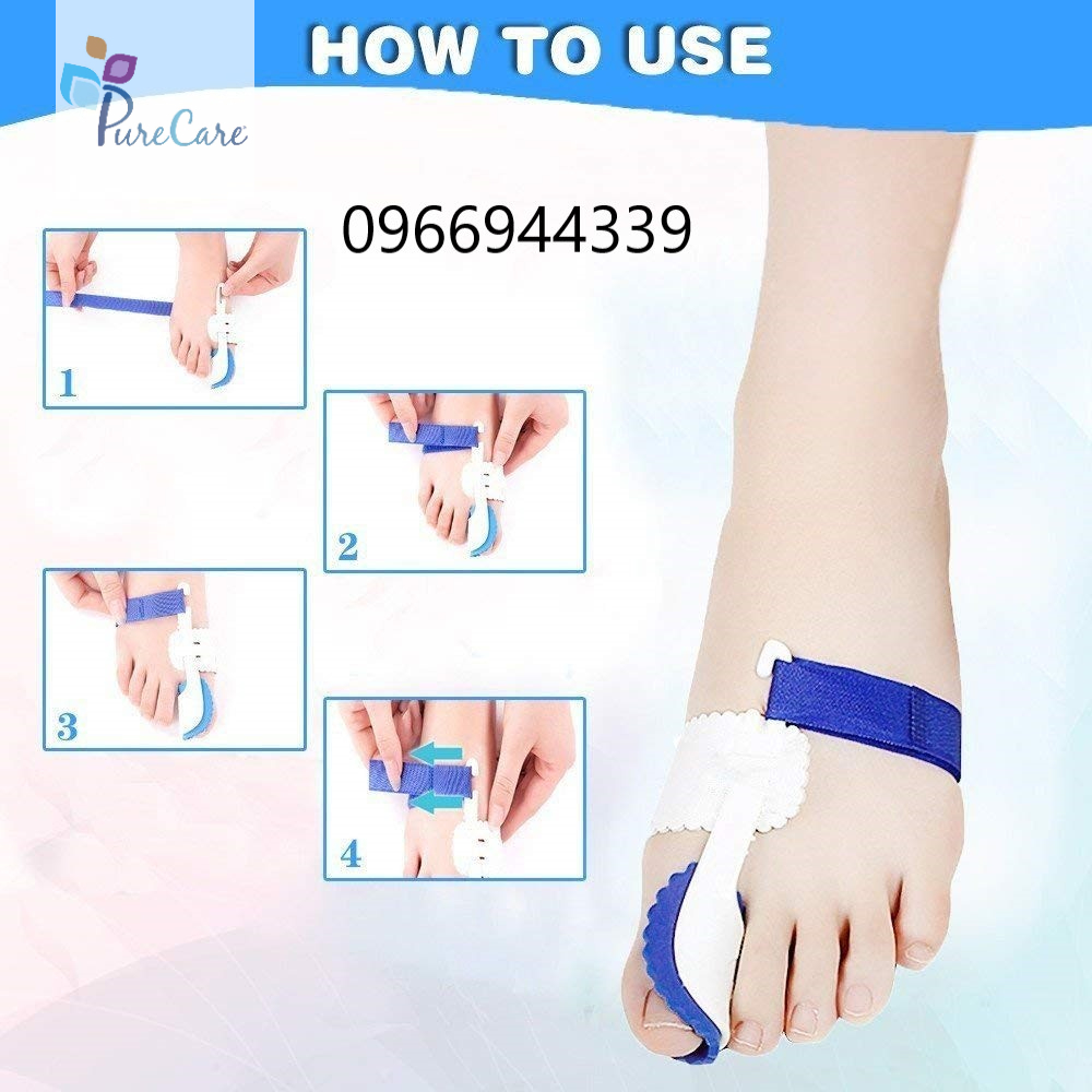 Nẹp duỗi thẳng cho người vẹo ngón chân cái