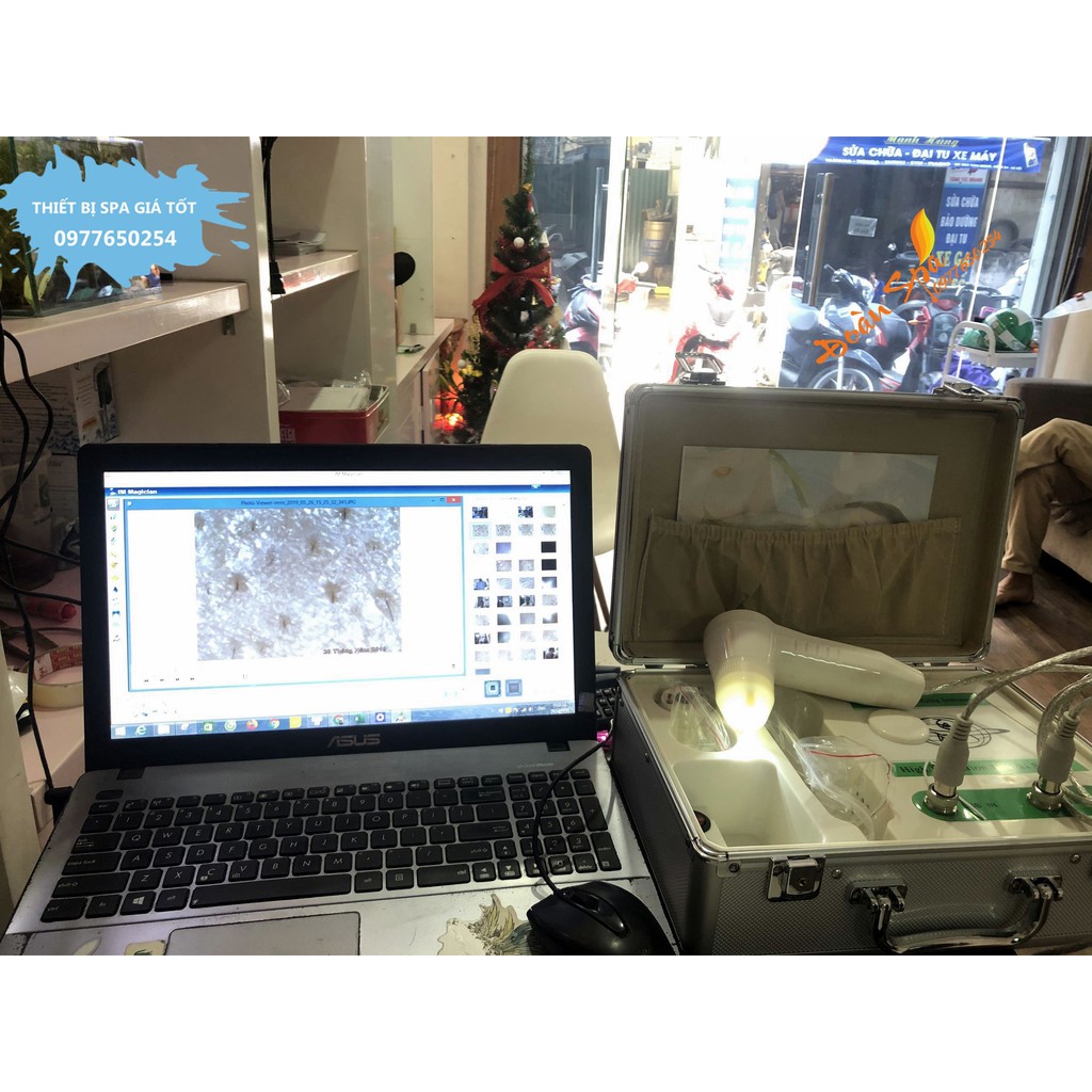 Máy soi da kết nối tivi dạng vali - Máy soi da TIVI