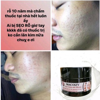 Set Serum Kem Xóa Sẹo Rỗ