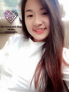Đá mỹ đính răng loại 1