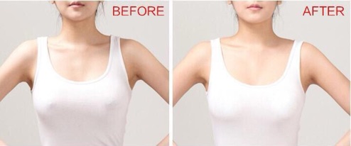 Miếng Dán Che Nhũ Hoa 1 Túi