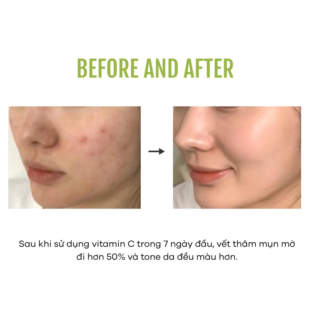 Serum Vitamin C Zakka Naturals Glow Fruit Brightening Dưỡng Trắng Da, Mờ Thâm, Căng Bóng Và Chống Lão Hóa Da 20g | BigBuy360 - bigbuy360.vn