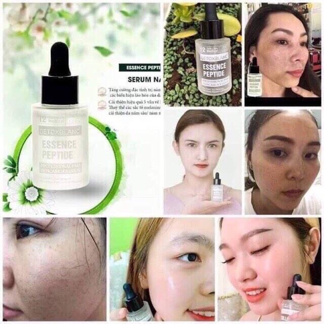 Mặt Nạ Thải Độc Trắng Da DETOX BLANC ( Cam Kết Chính Hãng) | BigBuy360 - bigbuy360.vn