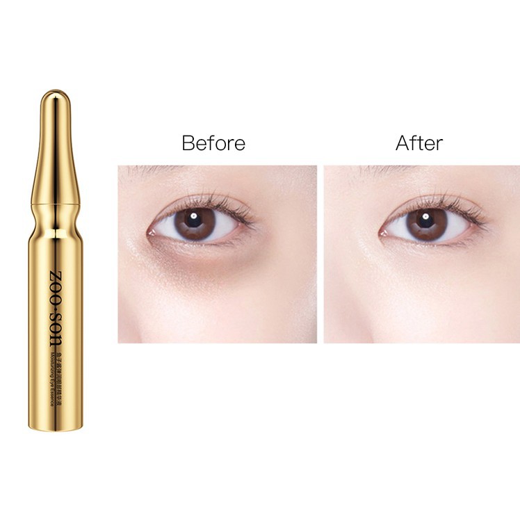 [Hàng mới về] Tinh Chất Trứng Cá Muối Dưỡng Ẩm Xóa Quầng Thâm / Bọng Mắt Dạng Đầu Lăn Tiện Lợi | BigBuy360 - bigbuy360.vn