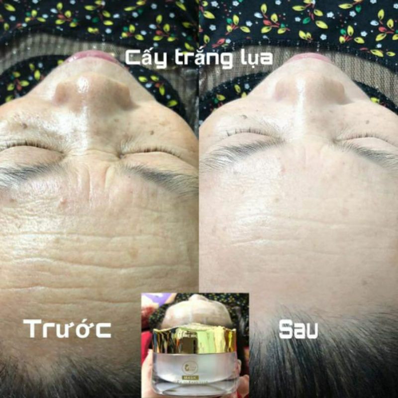 CẤY TRẮNG LỤA NANO COLLAGEN - SPA TẠI NHÀ | BigBuy360 - bigbuy360.vn