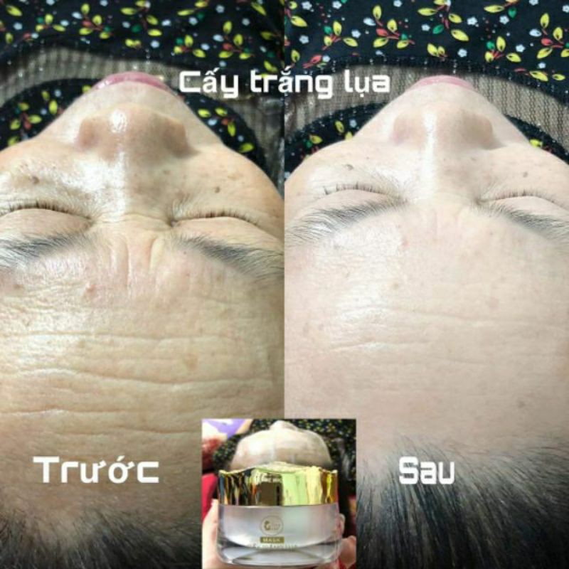 CẤY TRẮNG LỤA NANO COLLAGEN - SPA TẠI NHÀ