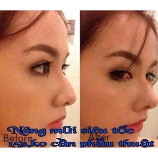 Combo 3 Bộ Sụn Nâng Đầu Mũi 3D SNM 3 Size