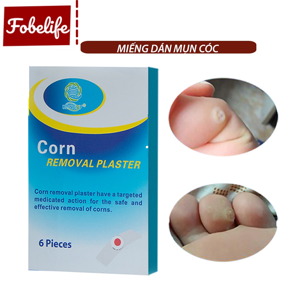 [Mã FMCGMALL -8% đơn 250K] Miếng Dán Mụn Cóc Corn plaster KangDi Fobe - hộp 6 miếng