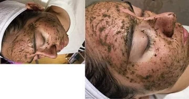 1 hộp btox peel 2 màu dùng trong spa thẫm mỹ viện