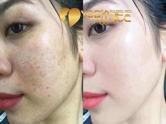 KEM DƯỠNG TRẮNG DA TÁI TẠO BAN ĐÊM SU SKIN