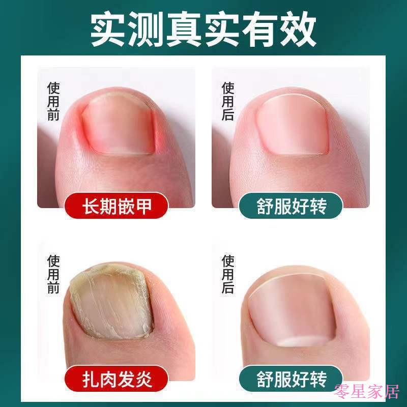 Z Bộ Kềm Cắt Móng Tay / Móng Chân Bằng Thép Không Gỉ Chuyên Dụng