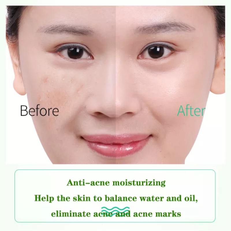 Gel Lô Hội 92% Dưỡng Ẩm Làm Dịu Da