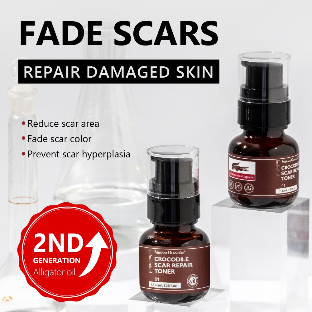 Set 3 Món Serum + Toner + Kem VIBRANT GLAMOUR Dưỡng Ẩm Làm Trắng Hỗ Trợ Mờ Thâm Giảm Sẹo Và Vết Rạn Da | BigBuy360 - bigbuy360.vn