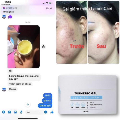 Gel giảm thâm mụn Dr. Lacir Tumeric Gel dưỡng trắng mờ thâm 50gr LM21