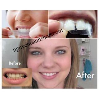  [Miếng Lẻ] Miếng dán trắng răng Crest 3D White Professional Effects