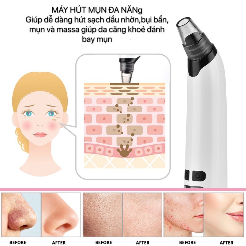 Máy Hút Mụn Cầm Tay - Máy Hút Mụn Đầu Đen Có Đầu Massage Nhiệt Nhiều Chế Độ Hút