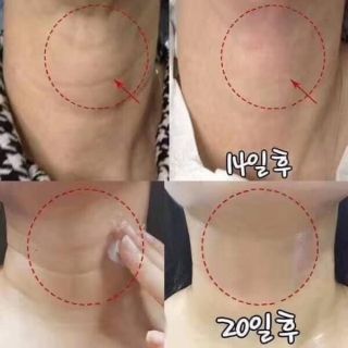 KEM DƯỠNG DÀNH CHO CỔ MEDI PEEL