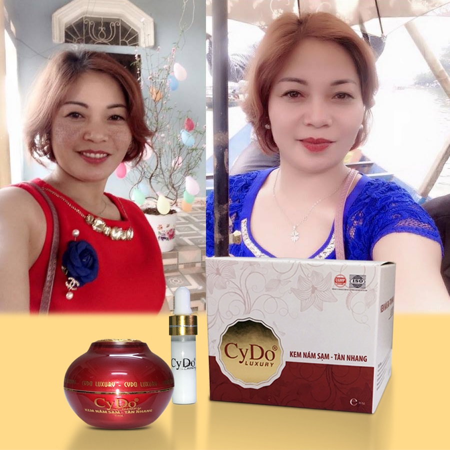 KEM NÁM SẠM, TÀN NHANG LUXURY CYDO 30G