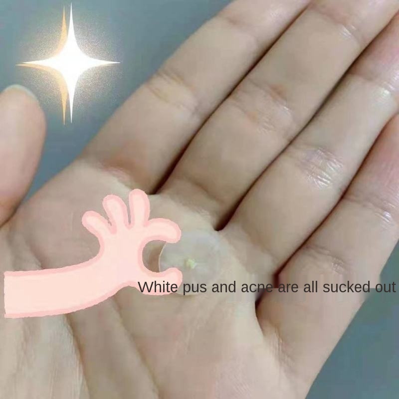 Miếng dán che khuyết điểm và che mụn sử dụng hàng ngày tiện dụng