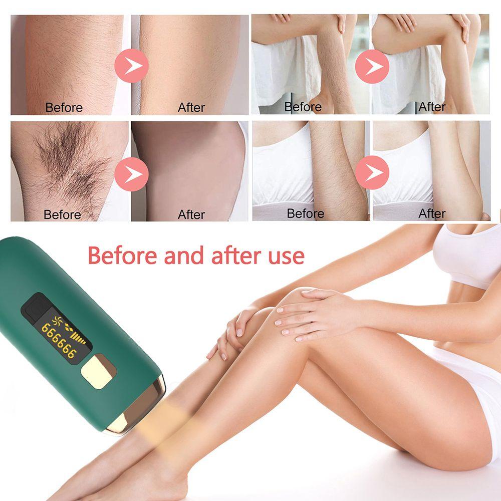 Máy Triệt Lông Bằng Tia Laser IPL Tự Động Không Đau Cho Vùng Da Dưới Cánh Tay