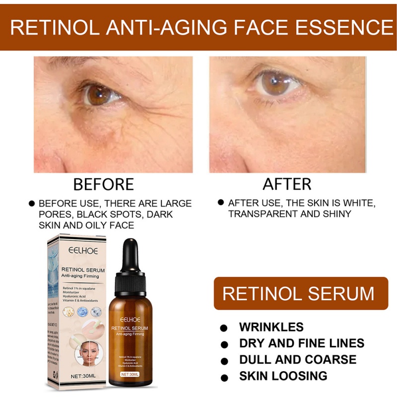Tinh Chất Retinol Chống Lão Hóa Xóa Nếp Nhăn Dưỡng Ẩm Làm Săn Chắc Và Sáng Da