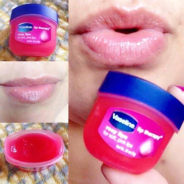 Sáp Dưỡng Môi Hồng Xinh Xắn Vaseline Lip Therapy 7g