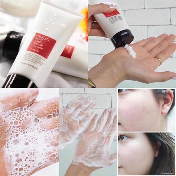 Sữa rửa mặt dành cho da dầu mụn và tẩy tế bào chết Cosrx Salicylic Acid Daily Gentle Cleanser 150ml