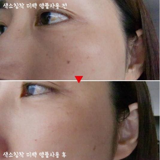 Kem nám Dongsung mini, kem Dongsung Rannce Cream mini 10g | BigBuy360 - bigbuy360.vn