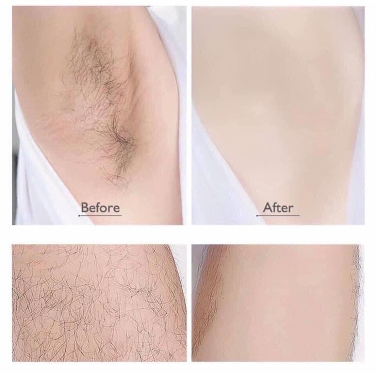 Xịt Was Tẩy Triệt Lông DETVFO (Nách-Bikini-Chân-Toàn Thân) ( Hàng Sẵn) | BigBuy360 - bigbuy360.vn