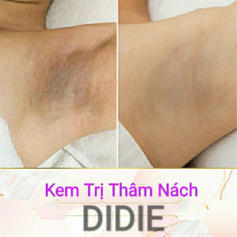 Kem Xóa Thâm Nách Mềm Mại DIDIE