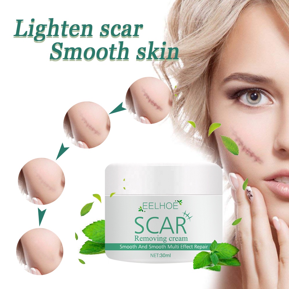 Kem xóa sẹo JULYSTAR loại bỏ hiệu quả mụn/ rạn da/ làm mờ vết sẹo/ thúc đẩy tái tạo tế bào dưỡng ẩm làm mịn