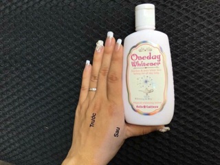 Kem dưỡng trắng Oneday